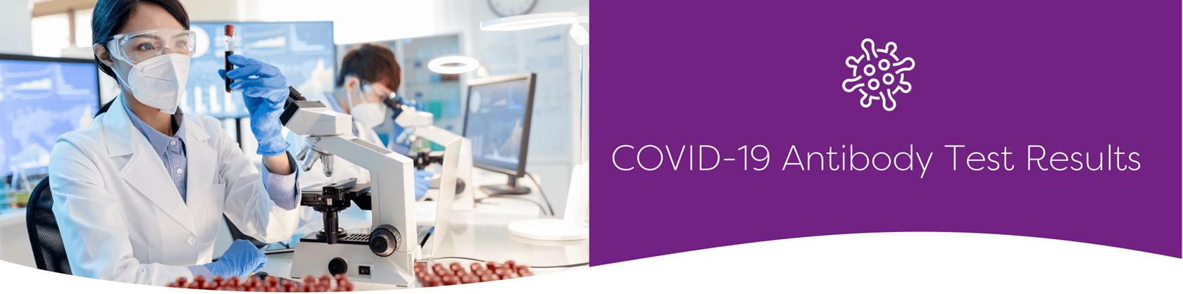 covid 19 antibody tests